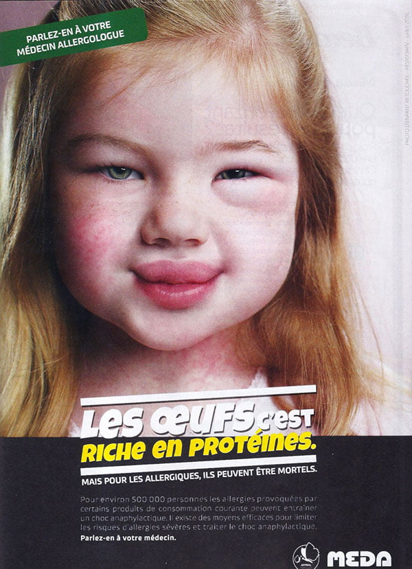 Publicité allergie aux oeufs